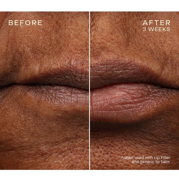 $15❤️‍🔥 LAST 1! Ourself Lip Filler Plumping 👄 NEW Hyaluronic Acid Technology - Picture 3 of 6